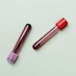 4 Blutgruppen und ihre Rolle bei Krankheiten